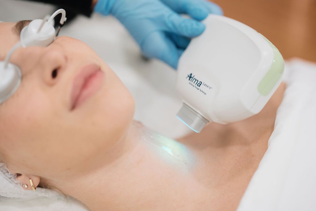 Radiofrecuencia facial fraccionada Venus Viva en Sevilla