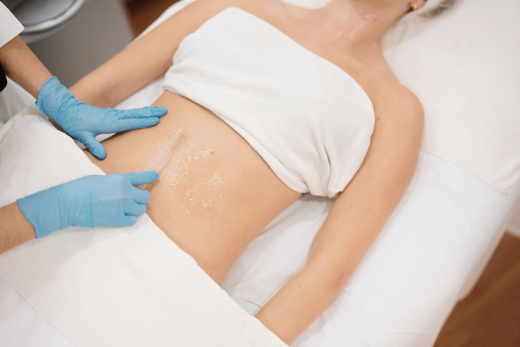 Radiofrecuencia corporal Venus Legacy para celulitis y flacidez en Sevilla